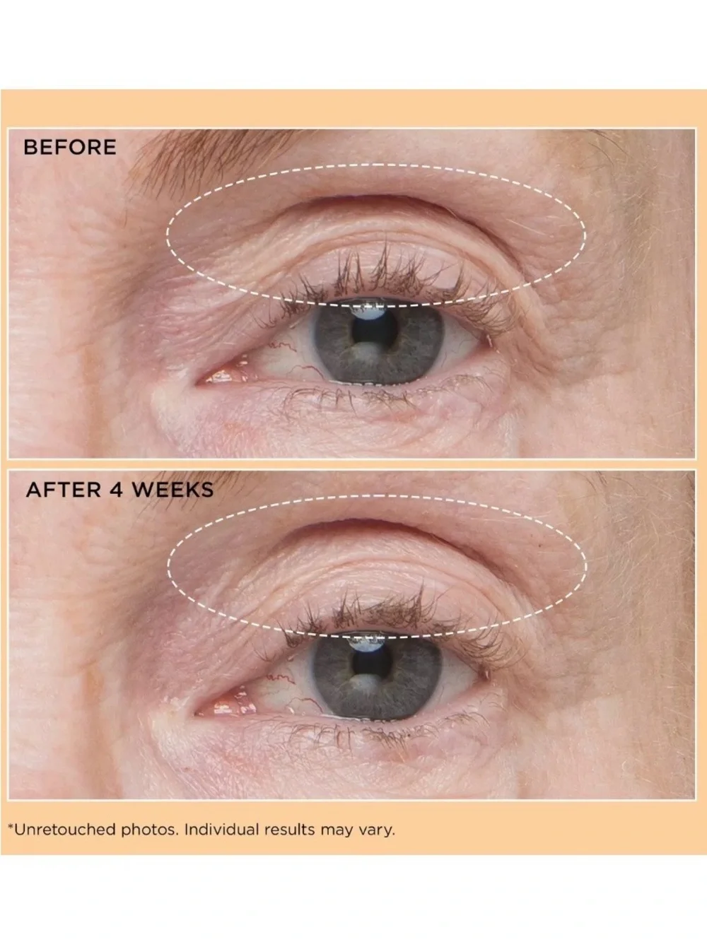 NIB Perricone MD Eyelid Lift Serum with Acyl-Glutathione and a Vitamin F blend.